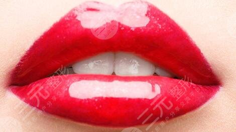 非手術(shù)豐唇方法有哪些？微創(chuàng)豐唇方法大全~