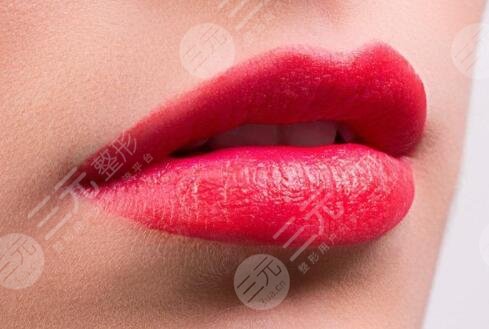 豐唇注意事項(xiàng)