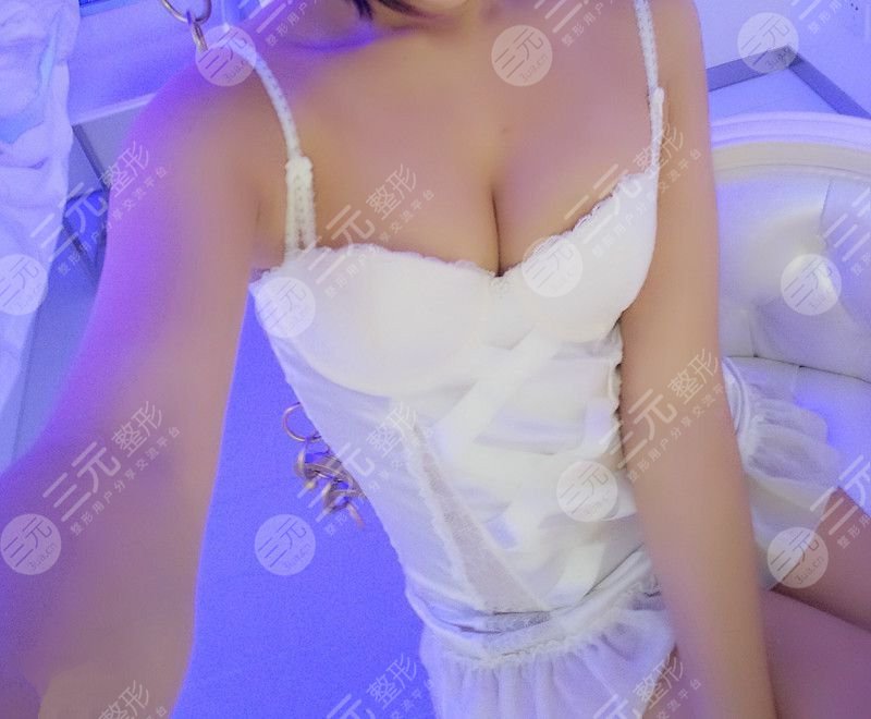 乳房縮小術(shù)前后對(duì)比,看了你就相信杭州美來比較好!