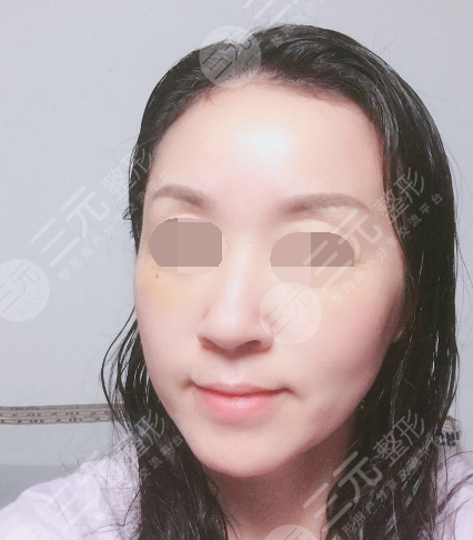 面部年輕化plus全臉，快速解決面部問題，內(nèi)附真實案例分享圖