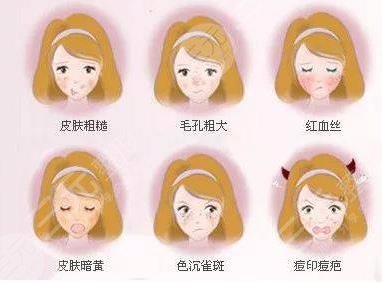 光子嫩膚適合哪些人群進行操作?