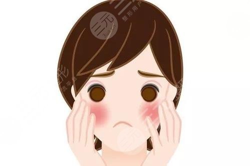 怎么去臉上的紅血絲