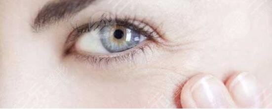 去掉眼角魚尾紋的價(jià)格是多少錢？真實(shí)術(shù)后果參考一下~
