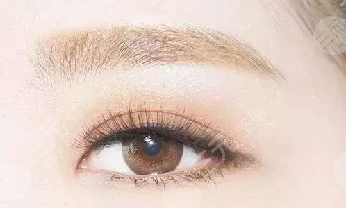 植眉毛多久能恢復(fù)正常？植眉手術(shù)成好嗎？有哪些注意事項(xiàng)呢？