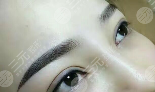 眉毛種植手術(shù)的成好嗎