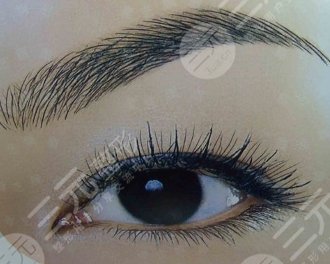 植眉手術(shù)的注意事項(xiàng)