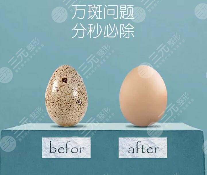 激光祛黃褐斑的價(jià)格