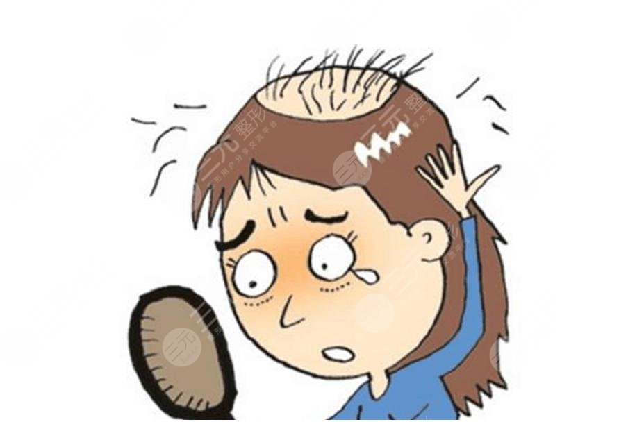 植發(fā)后還會脫落嗎？能夠維持多久？附術(shù)后注意事項