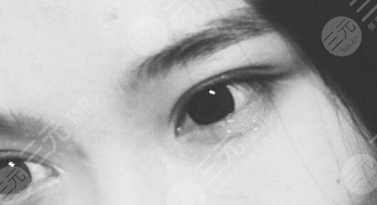 雙眼皮風(fēng)格