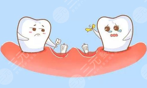 牙齒松動(dòng)怎么治好的辦法