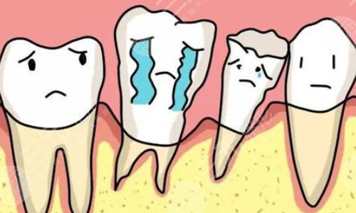 牙齒松動(dòng)怎么治好的辦法