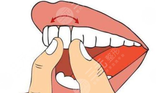牙齒松動(dòng)怎么治好的辦法