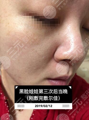 　黑臉娃娃親身體驗案例