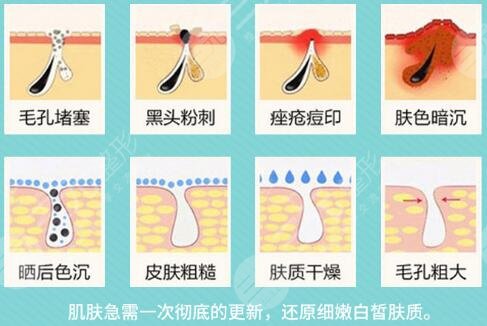 影響黑臉娃娃價(jià)格的因素