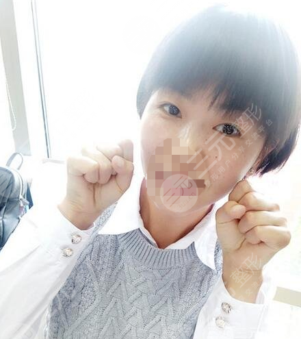 九院激光pm激光祛斑價(jià)格