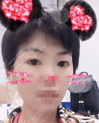 九院激光pm激光祛斑價(jià)格