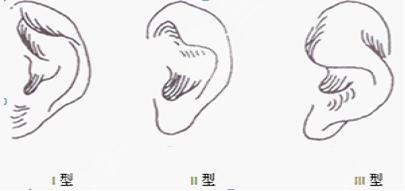 杯狀耳矯正多少錢