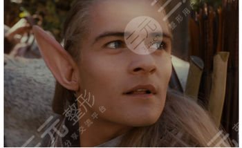 顱耳角在30°-60°之間朵怎么整形