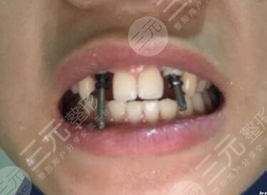 六安高峰口腔價(jià)格表