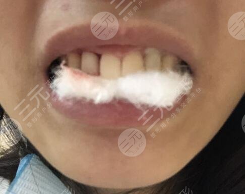 六安高峰口腔價(jià)格表