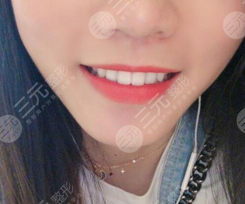 六安高峰口腔價(jià)格表