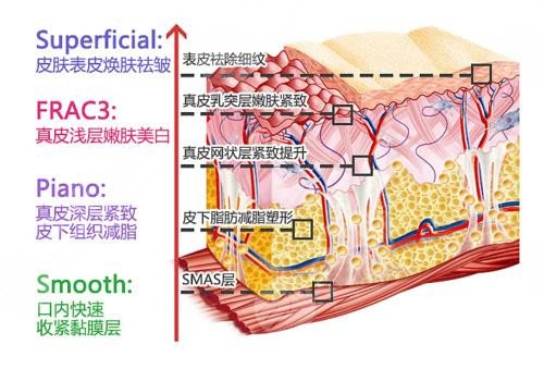 歐洲之星祛斑后可以化妝嗎