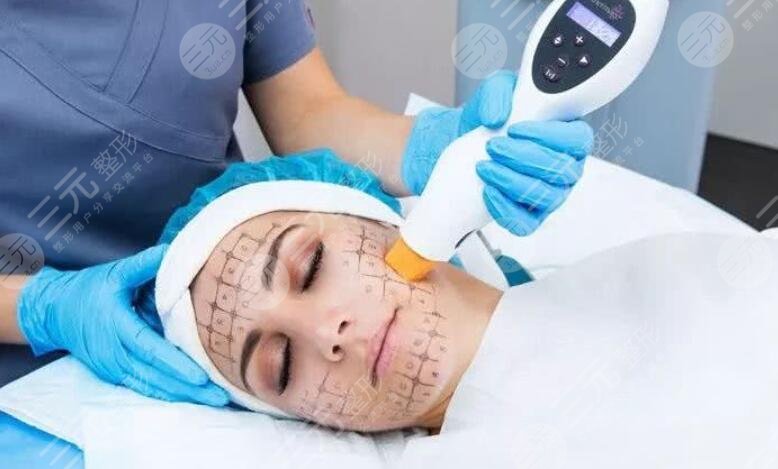 先做超聲提拉還是先做熱瑪吉比較好？專業(yè)人士告訴你怎么選！