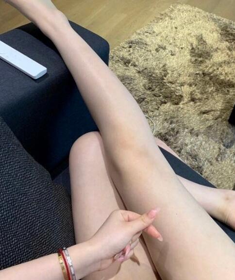 國(guó)內(nèi)吸脂醫(yī)院：北京禾美嘉大腿吸脂案例