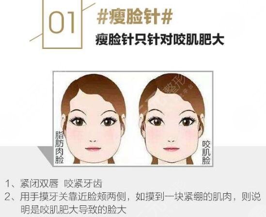 恩施天后整形醫(yī)院科普注射瘦臉