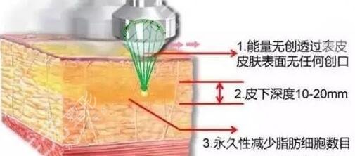 超脂塑塑型果維持時(shí)間久嗎?