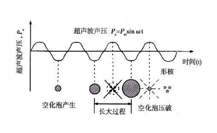 超脂塑術(shù)后恢復(fù)期是多久?