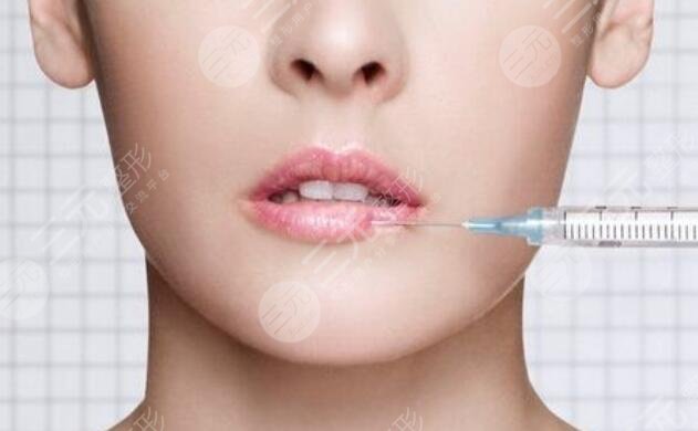 非手術(shù)豐唇