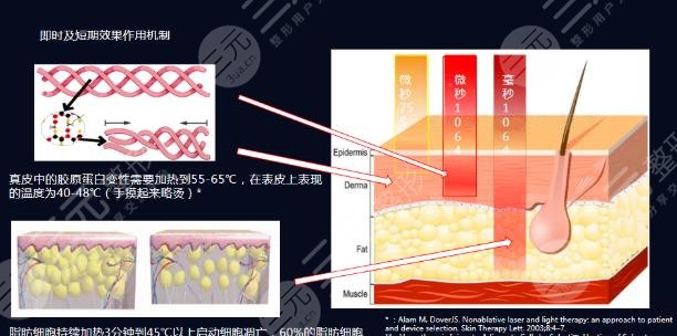 膠原光多久做一次