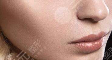 激光除皺術(shù)是光子嫩膚嗎