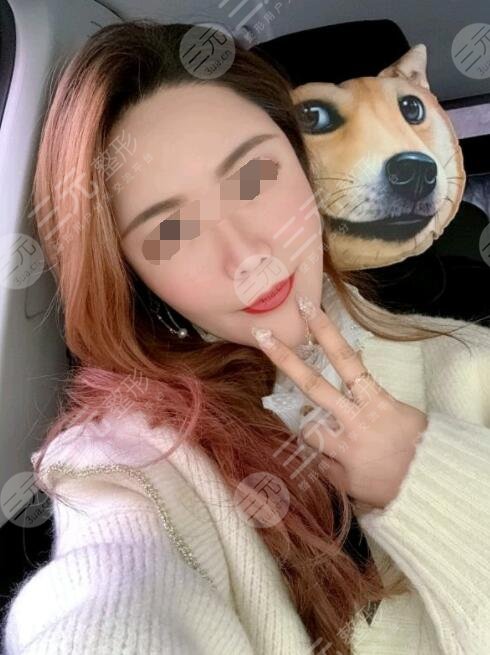 btl射頻緊膚真人案例后2個(gè)月