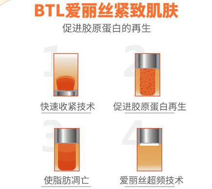 btl射頻溶脂