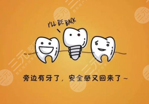 選擇好的種植體質(zhì)量