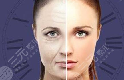 內(nèi)窺鏡除皺