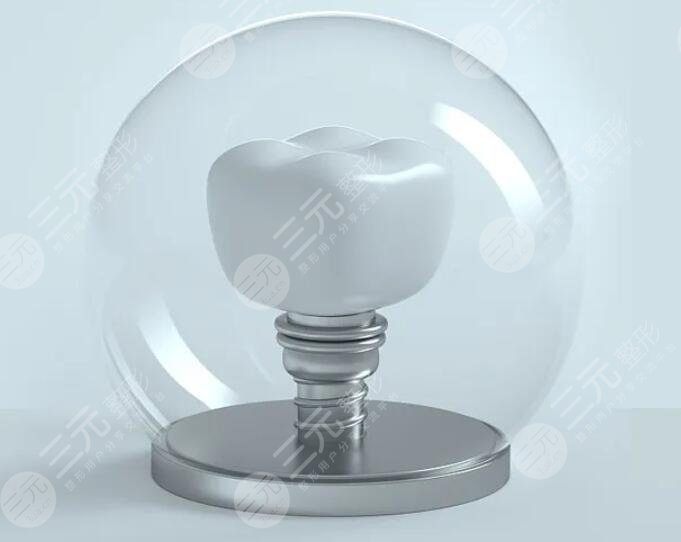 全口種植牙的弊