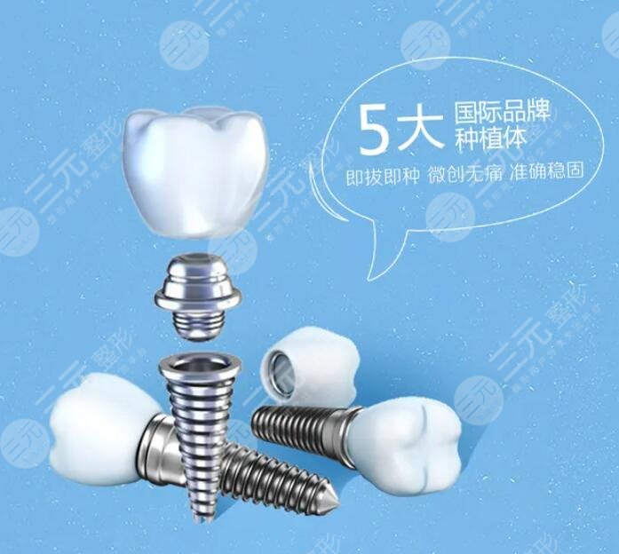 種植牙技術(shù)的價(jià)格