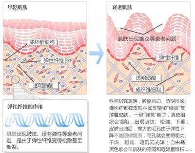 面部除皺有方法