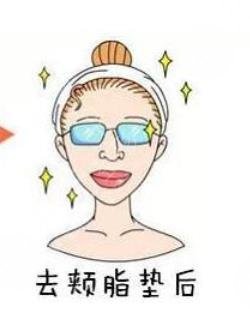 頰脂墊注意事項(xiàng)