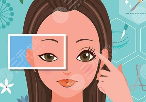 10個(gè)開內(nèi)眼角9個(gè)留疤怎么辦？怎么避免開眼角留疤？注意事項(xiàng)帶你了解！