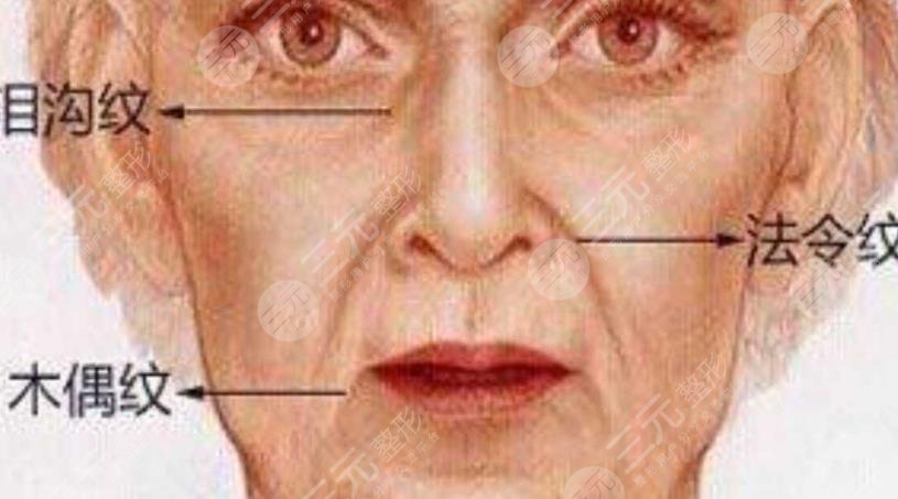 超聲提拉去法令紋果怎么樣