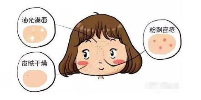 干貨分享|干皮vs油皮、油痘肌VS油敏肌，四者如何區(qū)分？怎么改良？