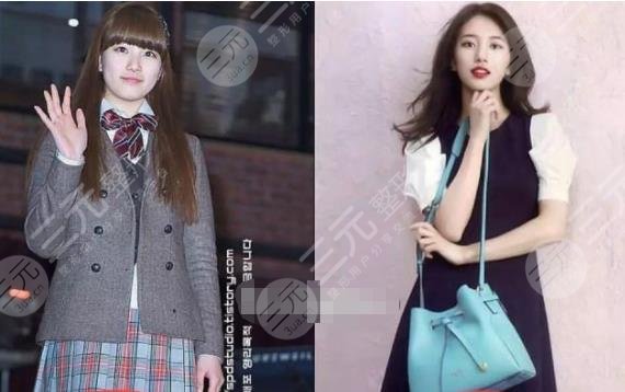 裴秀智微調(diào)整容參考標(biāo)準(zhǔn)！變美拿下李敏鎬，來看看她整了哪里！