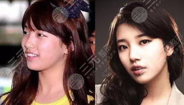 她動(dòng)了哪些地方?