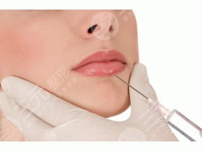 玻尿酸豐唇手術(shù)一般能維持多長時間?