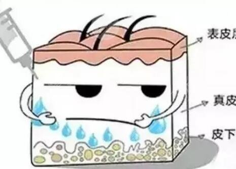 注射了水光補(bǔ)水皮膚變好了 水光補(bǔ)水注射后注意事項(xiàng)