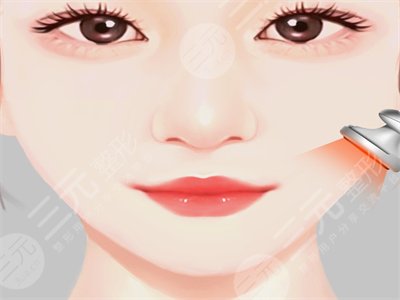 v-line改臉型瘦臉整形手術(shù)案例恢復全過程對比圖